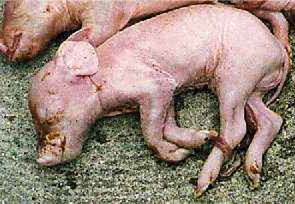 原来是中暑引起的死胎