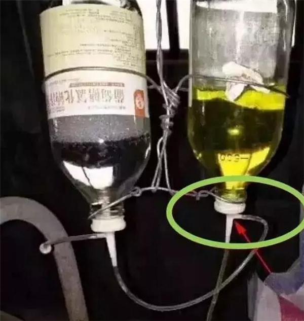 用输水带把两瓶药水连到一起，吊瓶打上，该忙什么就忙什么区，不用再短时间内再操心药水会下完。