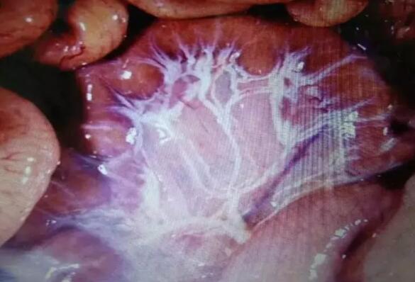 断奶仔猪大肠杆菌的临床症状有哪些?