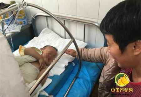 外公煮猪食外孙摔进锅 身体45%的皮肤被烫伤