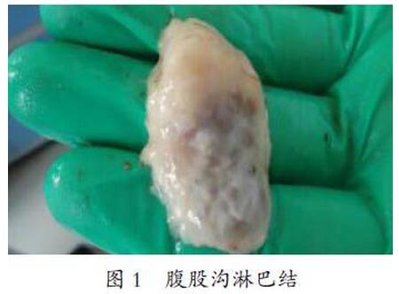 猪蓝耳病病毒、圆环病毒和大肠杆菌混合感染的诊断