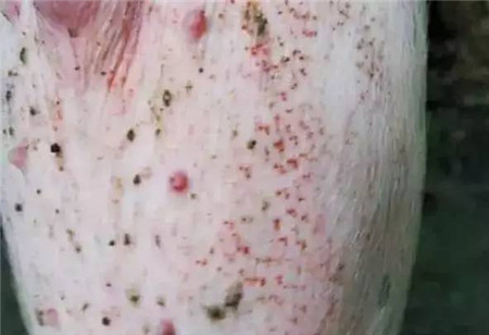 附红体、丹毒、圆环与蚊虫叮咬的区分和治疗