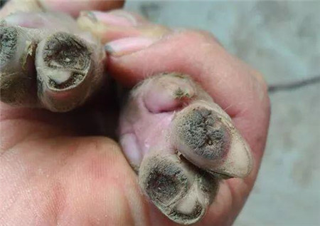 母猪蹄裂可不是小事，千万要重视！