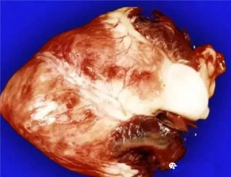 猪口蹄疫防治技术新变化