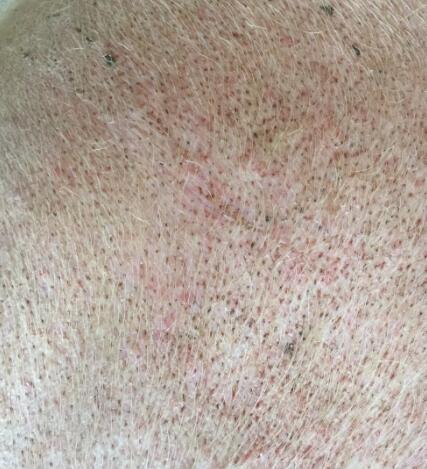 董广林：母猪群一旦出现这种情况，你就要小心了！