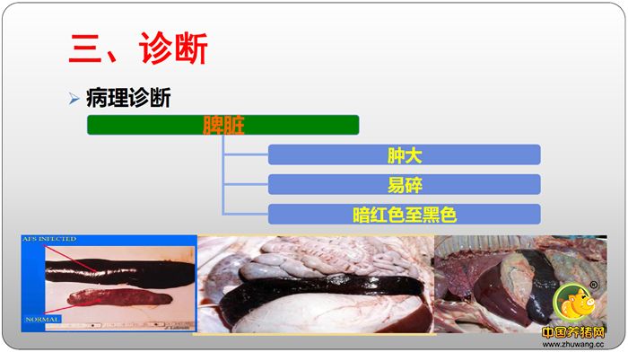 脾脏 肿大 暗红色至黑色