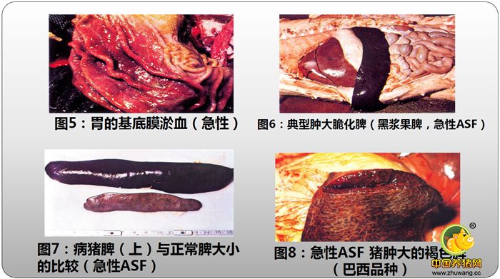 ：胃的基底膜淤血（急性）