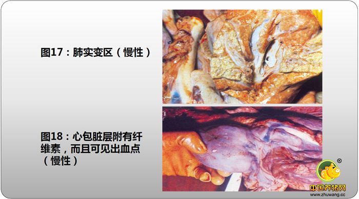 ：肺实变区（慢性）